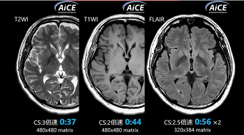 mri6