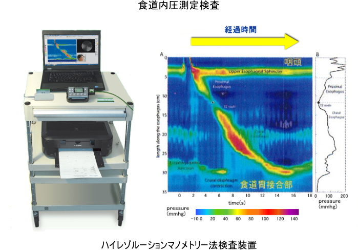 食道内圧測定